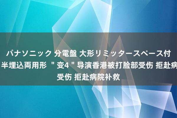 パナソニック 分電盤 大形リミッタースペース付 露出・半埋込両用形 ＂变4＂导演香港被打脸部受伤 拒赴病院补救